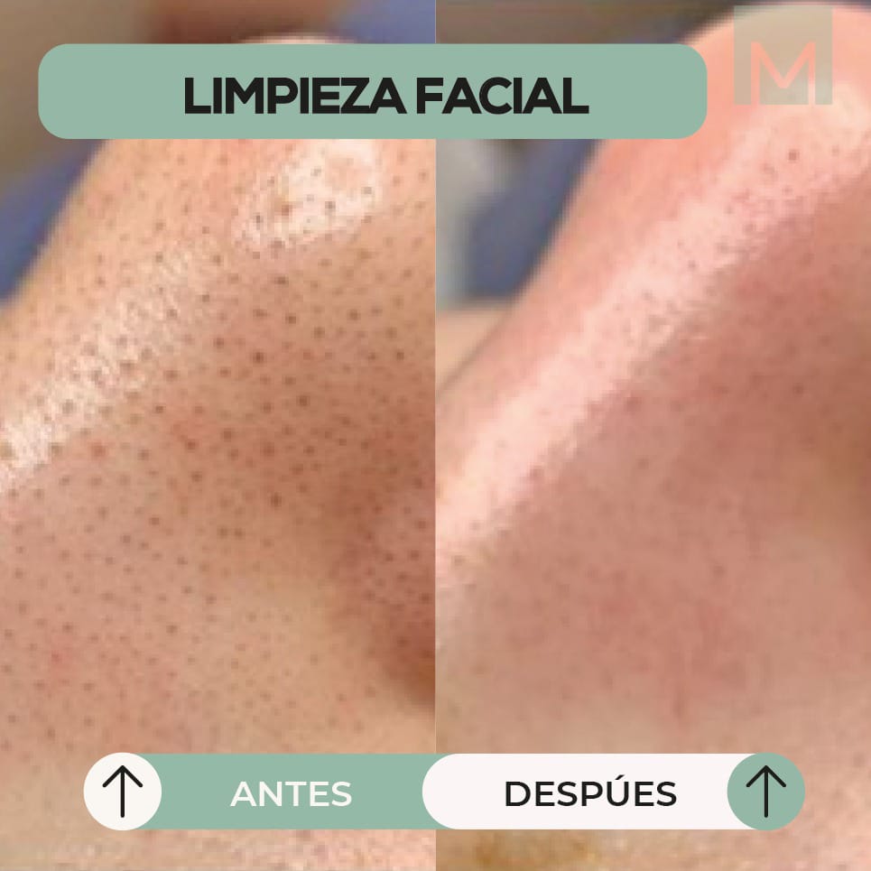 Limpieza2