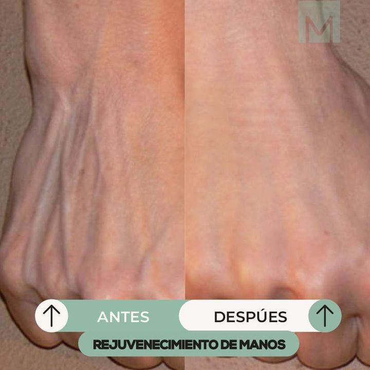 Manos1
